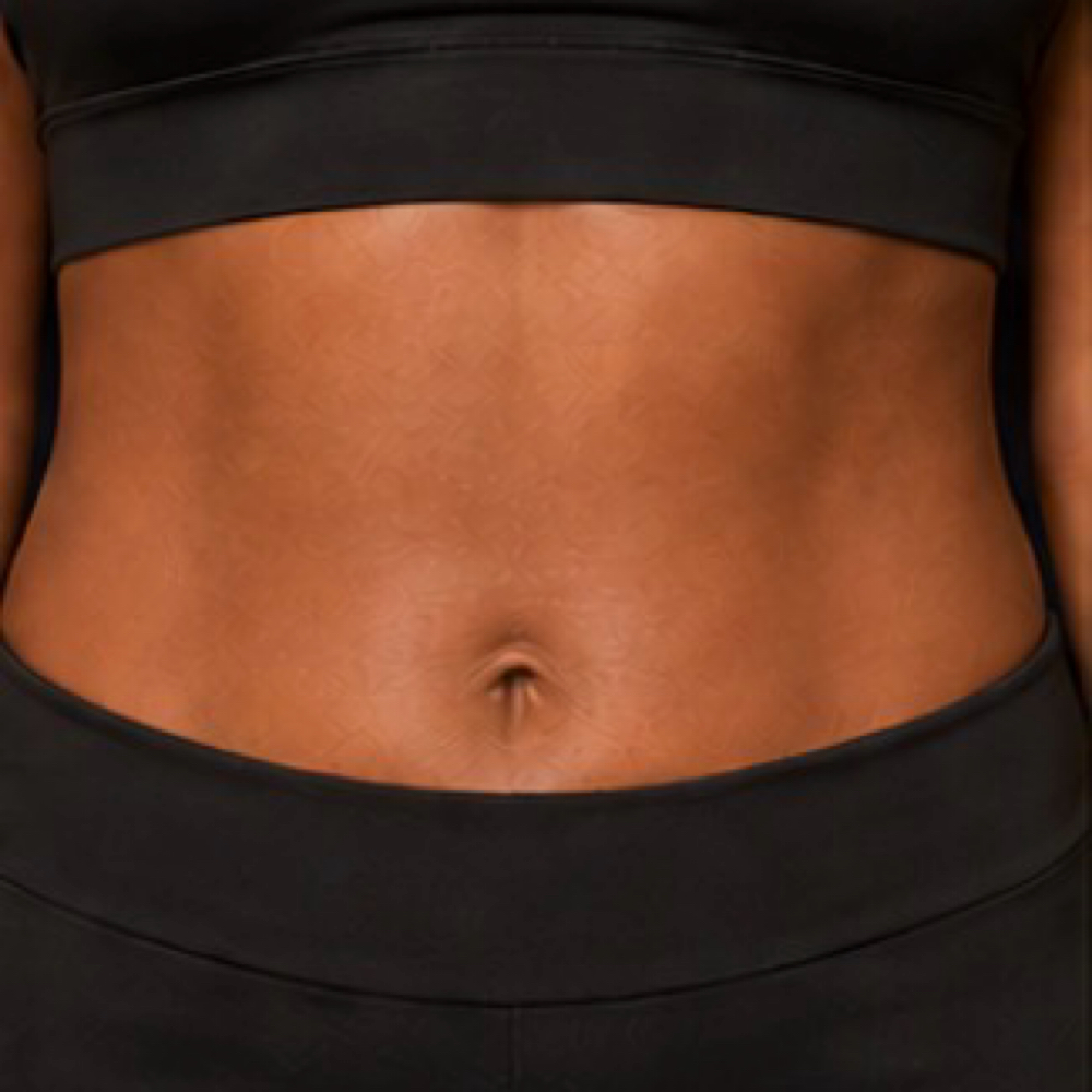 Stomach/Back Wax (read description) at Quinta Esthetics in Terrytown, LA
