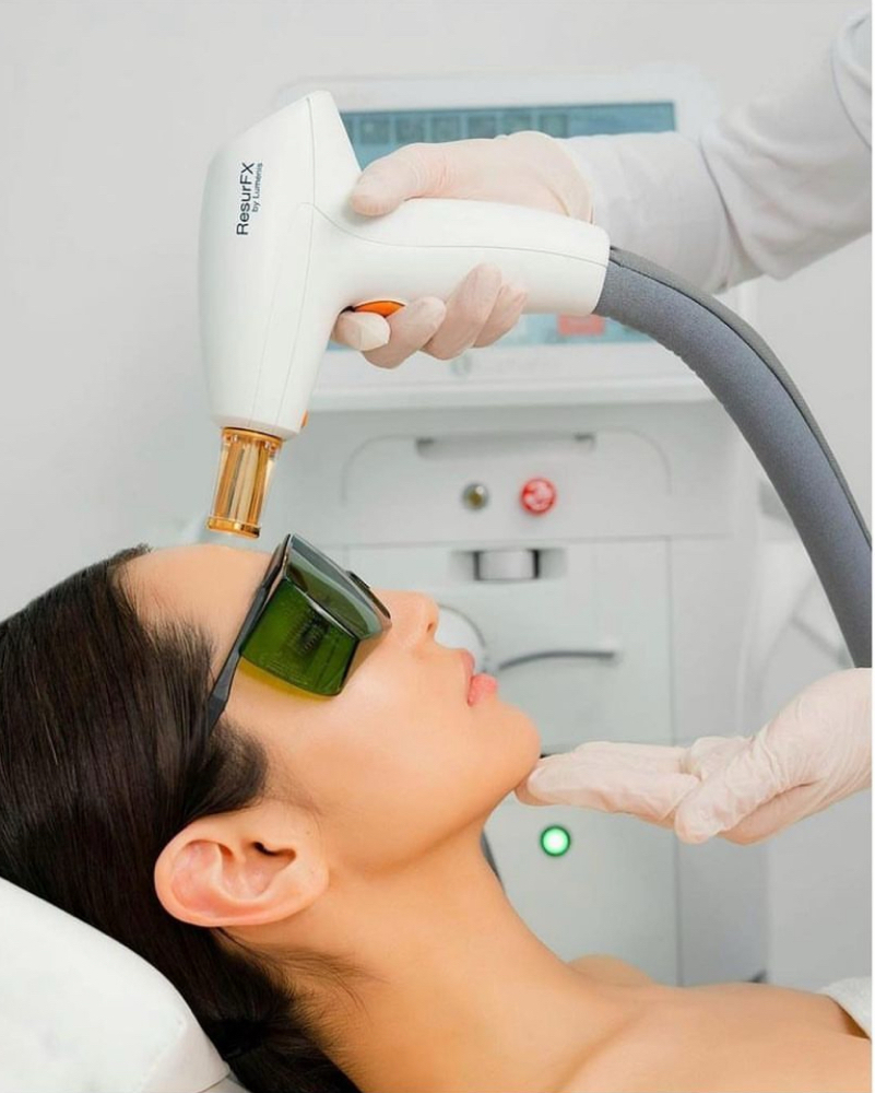 ResurFx Facial 1 Session