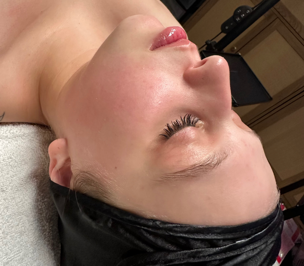 Dermaplaning Facial