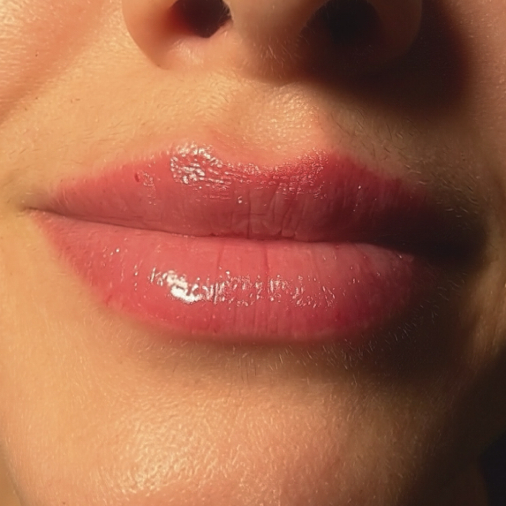 1ML LIP ENHANCEMENT at GLOW BY MARTINA in Grass Valley, CA
