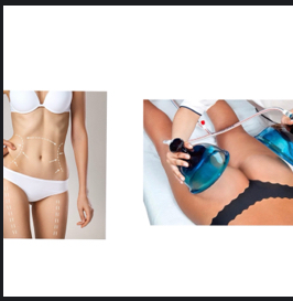 Special Package: Body Contouring (6