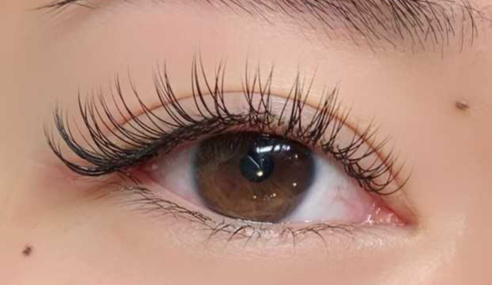 Classic Set at V Esthetics in Lynn, MA