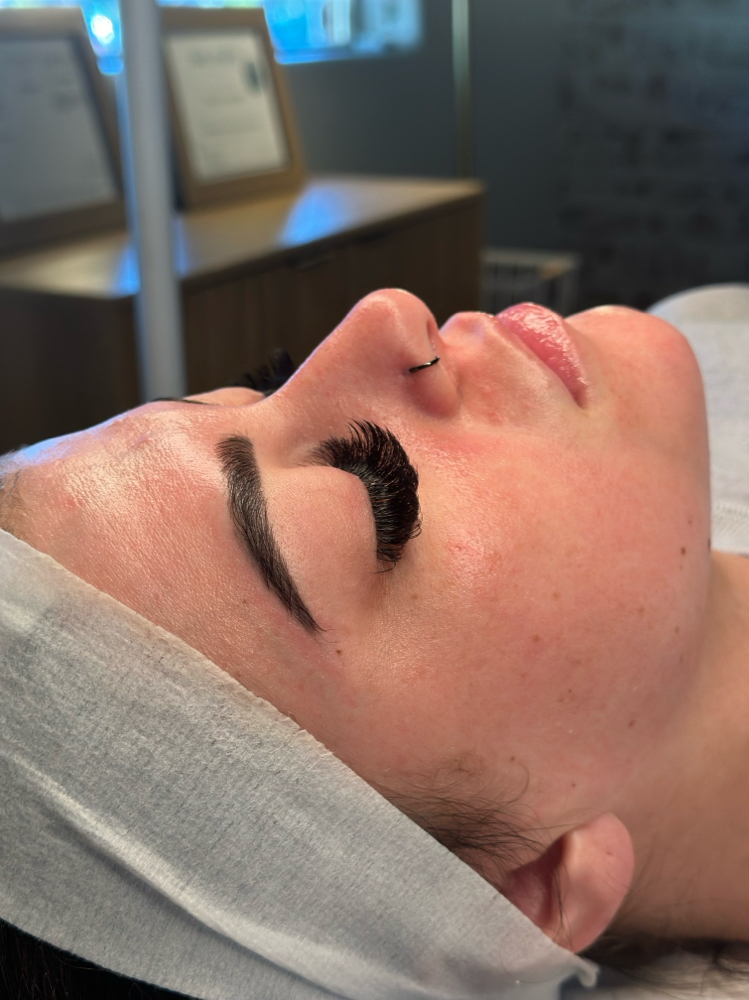 signature dermaplane facial