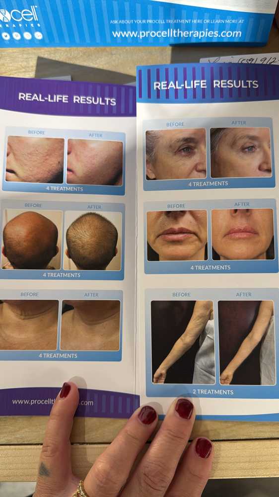 Procell Therapies at Lisa -Skin-Therapy in Fresno, CA