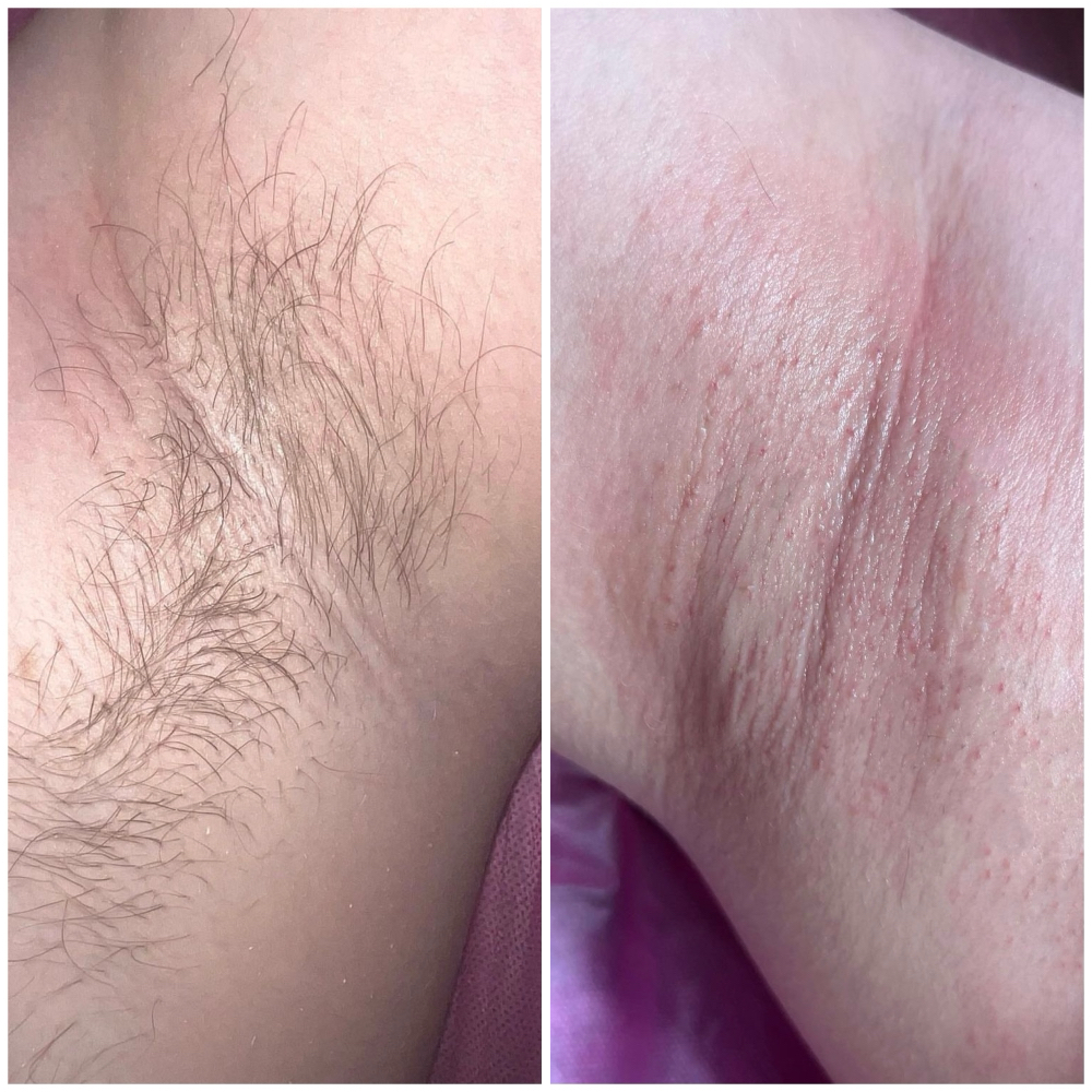 Underarms Wax