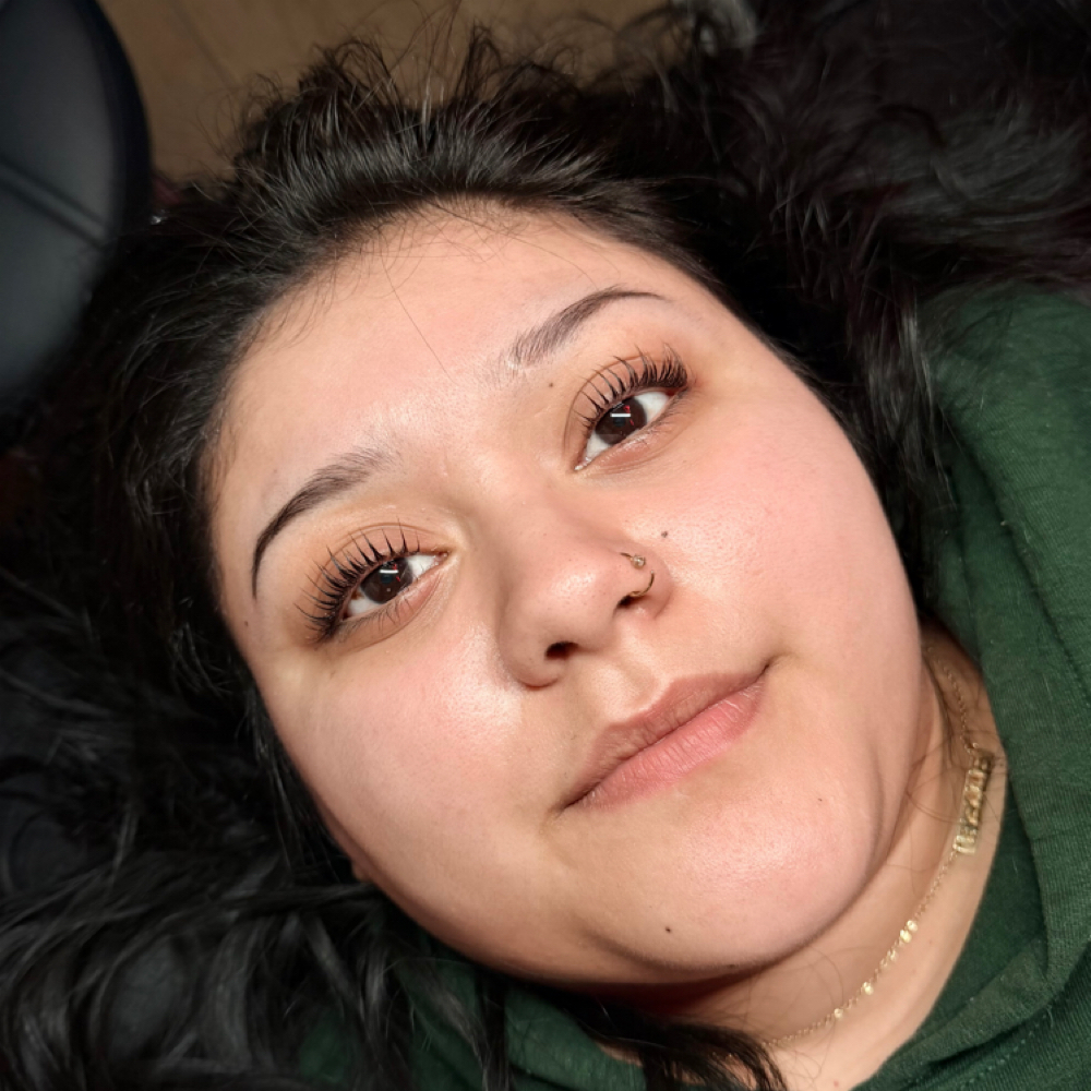 The MelRose Lift at MelRose Esthetics By Bridget in Racine, WI