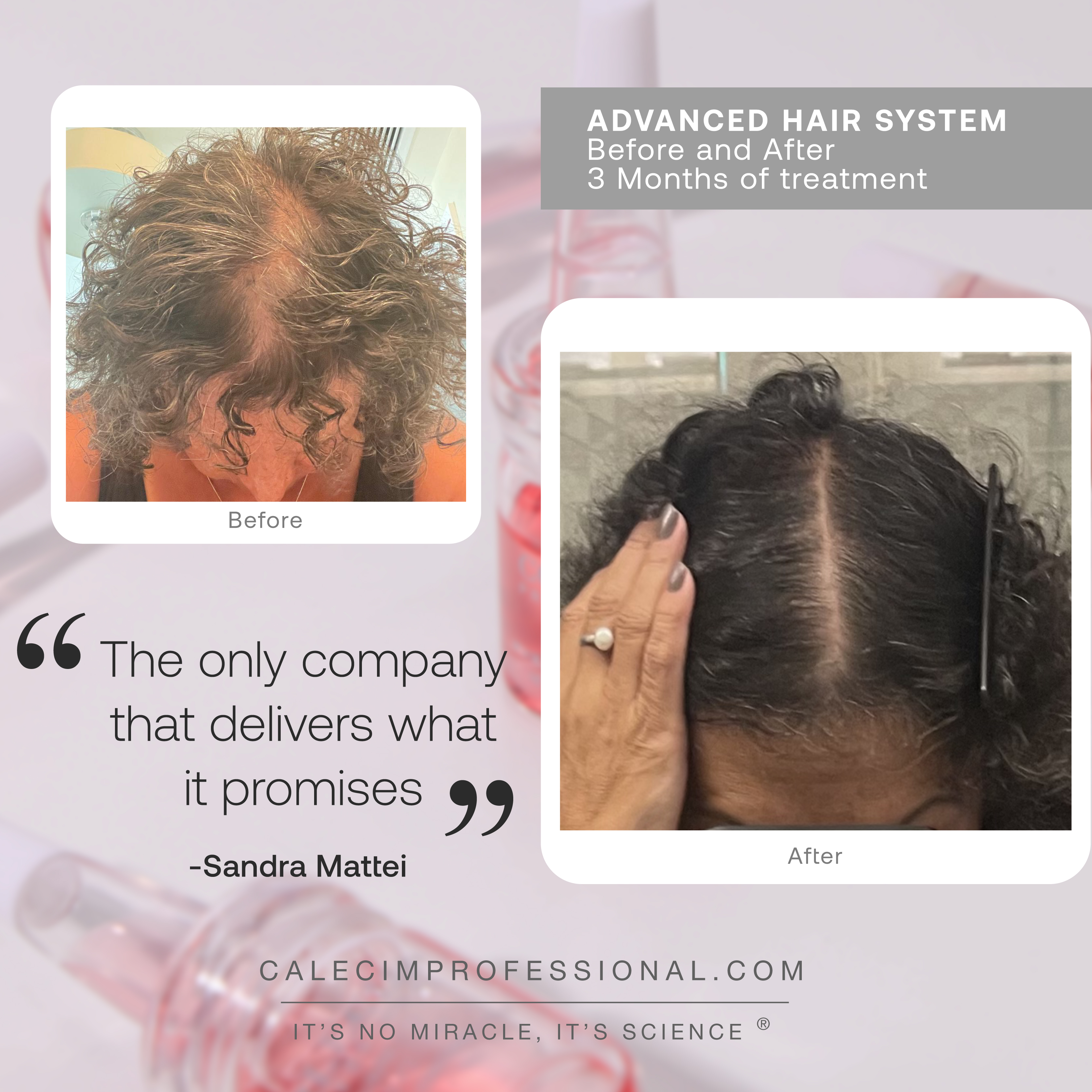 Calecim Hair Restoration