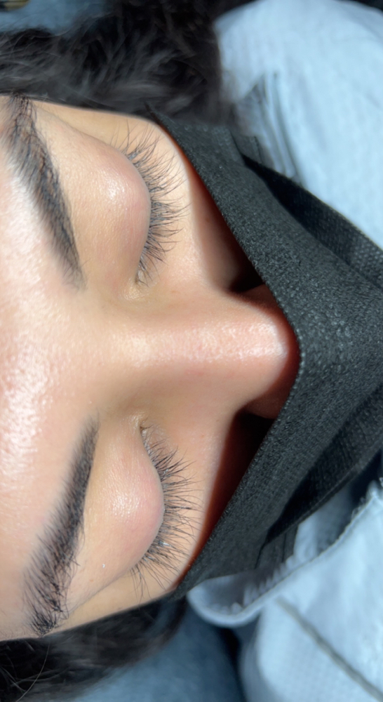 Lash Removal