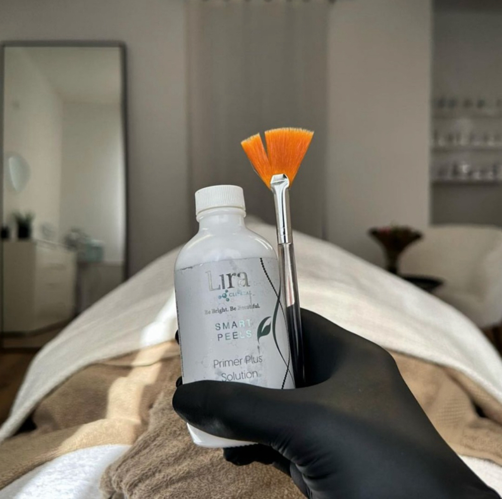 Light Chemical Peel at Cherry Glaze Esthetics in Camarillo, CA