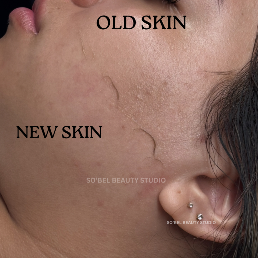 SIGNATURE FACIAL WITH DERMAPLANING at So’Bel Beauty Studio in Fort Myers, FL