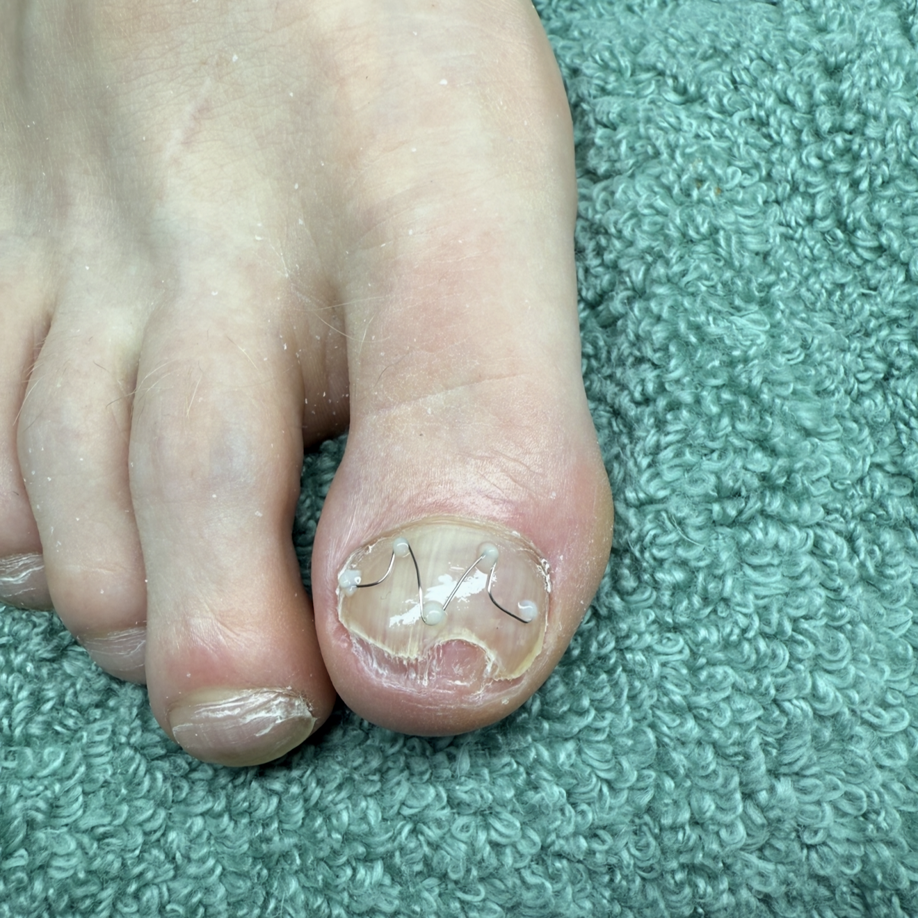 Advanced Perfect Nail Shape Big