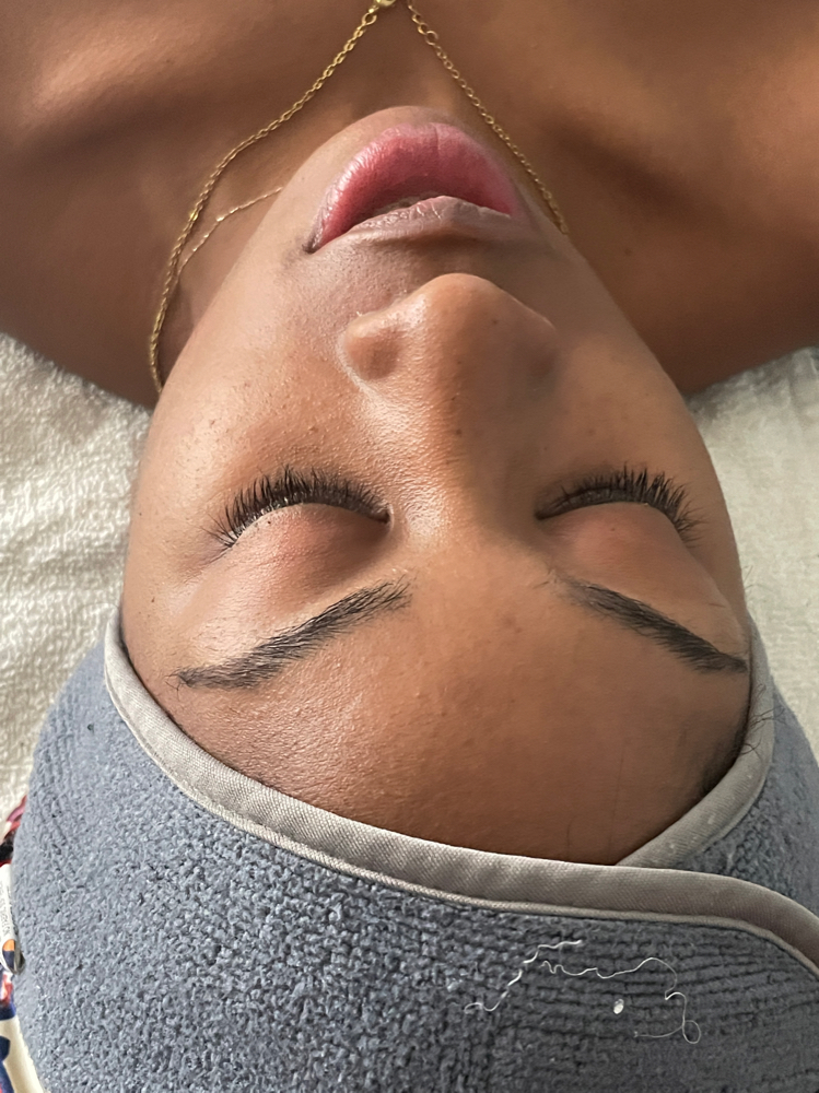 Microdermabrasion Facial