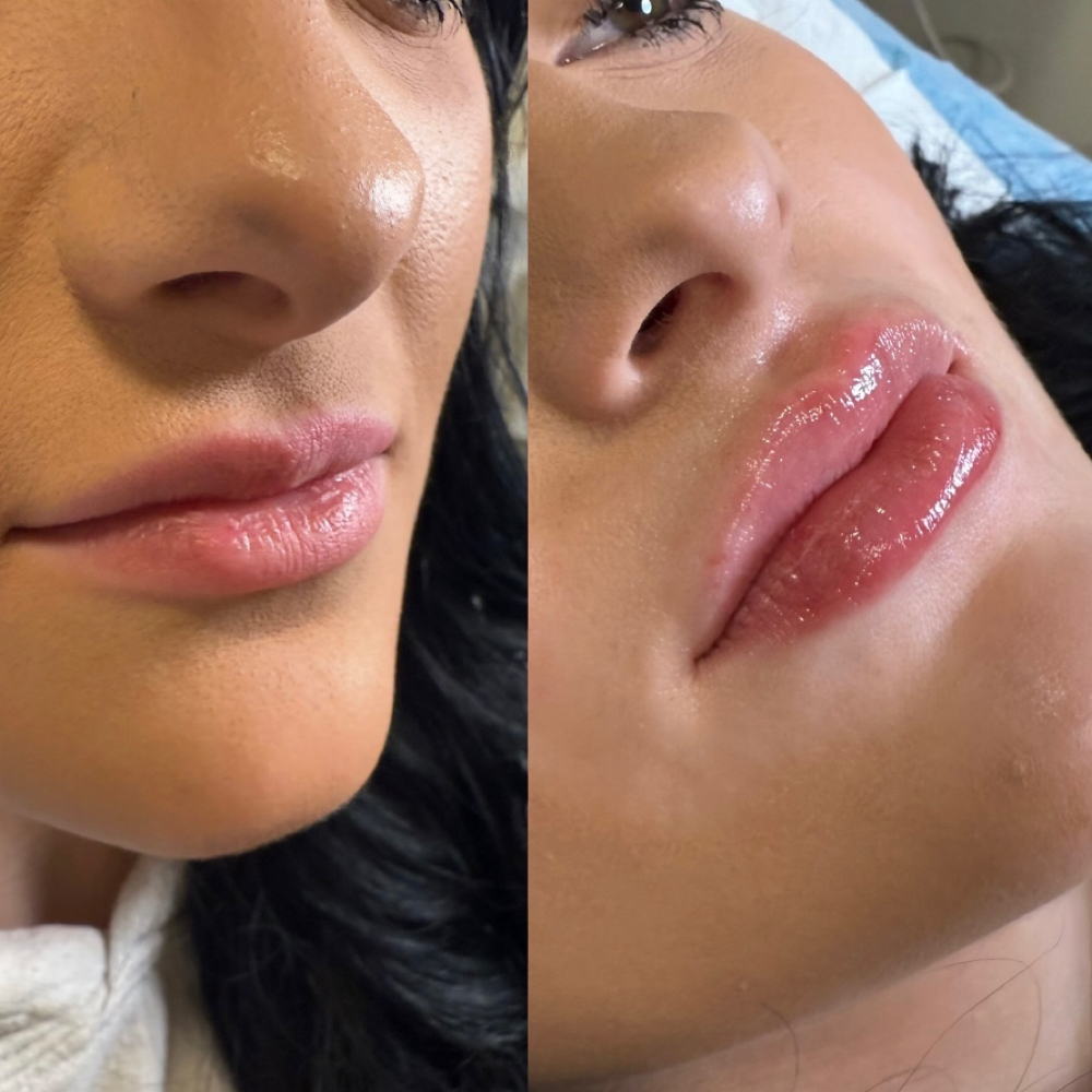 Lip Flip at ARock Beauty & Wellness in San Angelo, TX