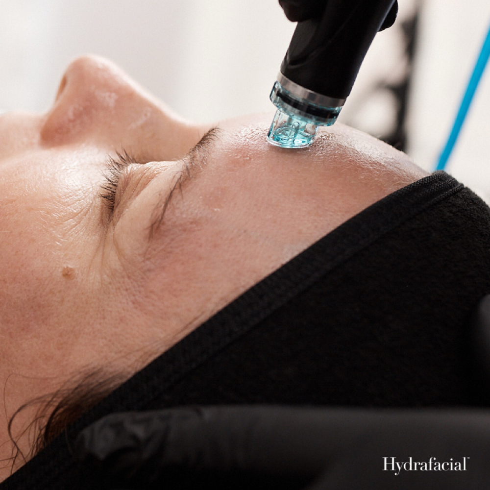 Deluxe Hydrafacial at BELLA HEADSPA in Southlake, TX