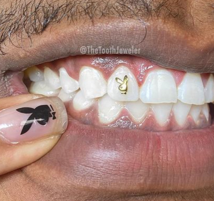 18kt Solid Gold Shaped Tooth Gems