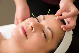 Cosmetic Acupuncture