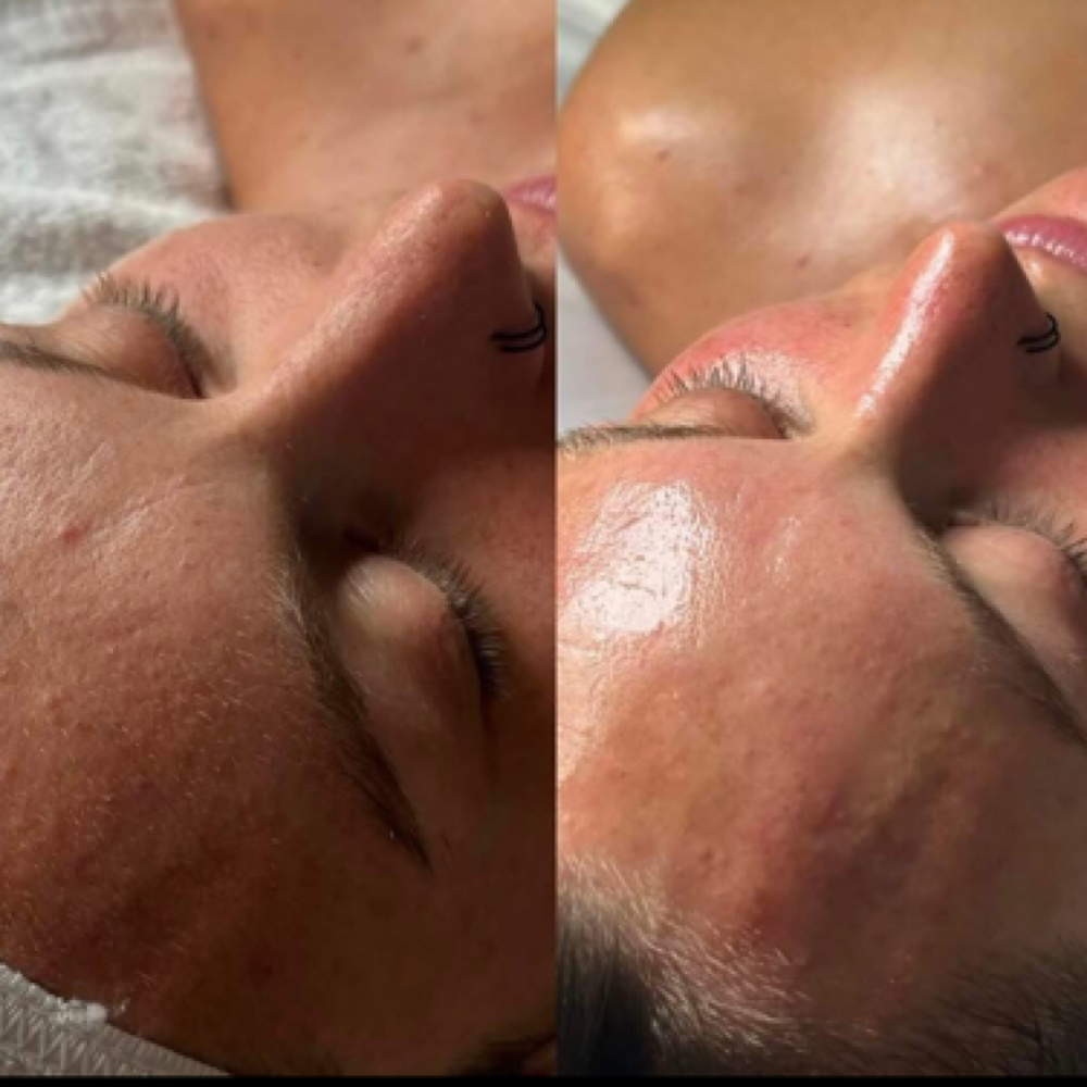 Reset + Refresh Facial at Bare Beauty By Alexis in Bay Saint Louis, MS
