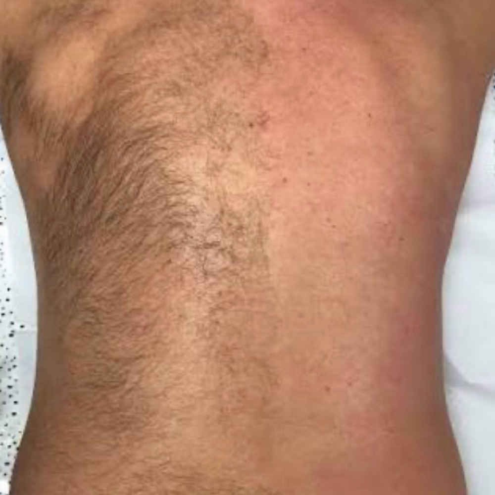 Back Waxing at Exquisite Beauty LLC in Houston, TX