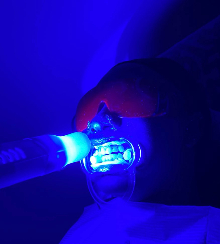 30 Minute Teeth Whitening at Double Up Boutique in Warwick, RI
