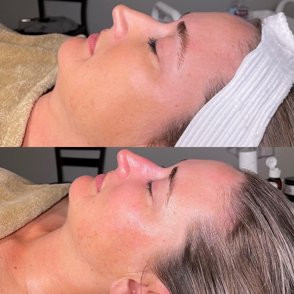 Renew & Glow Facial