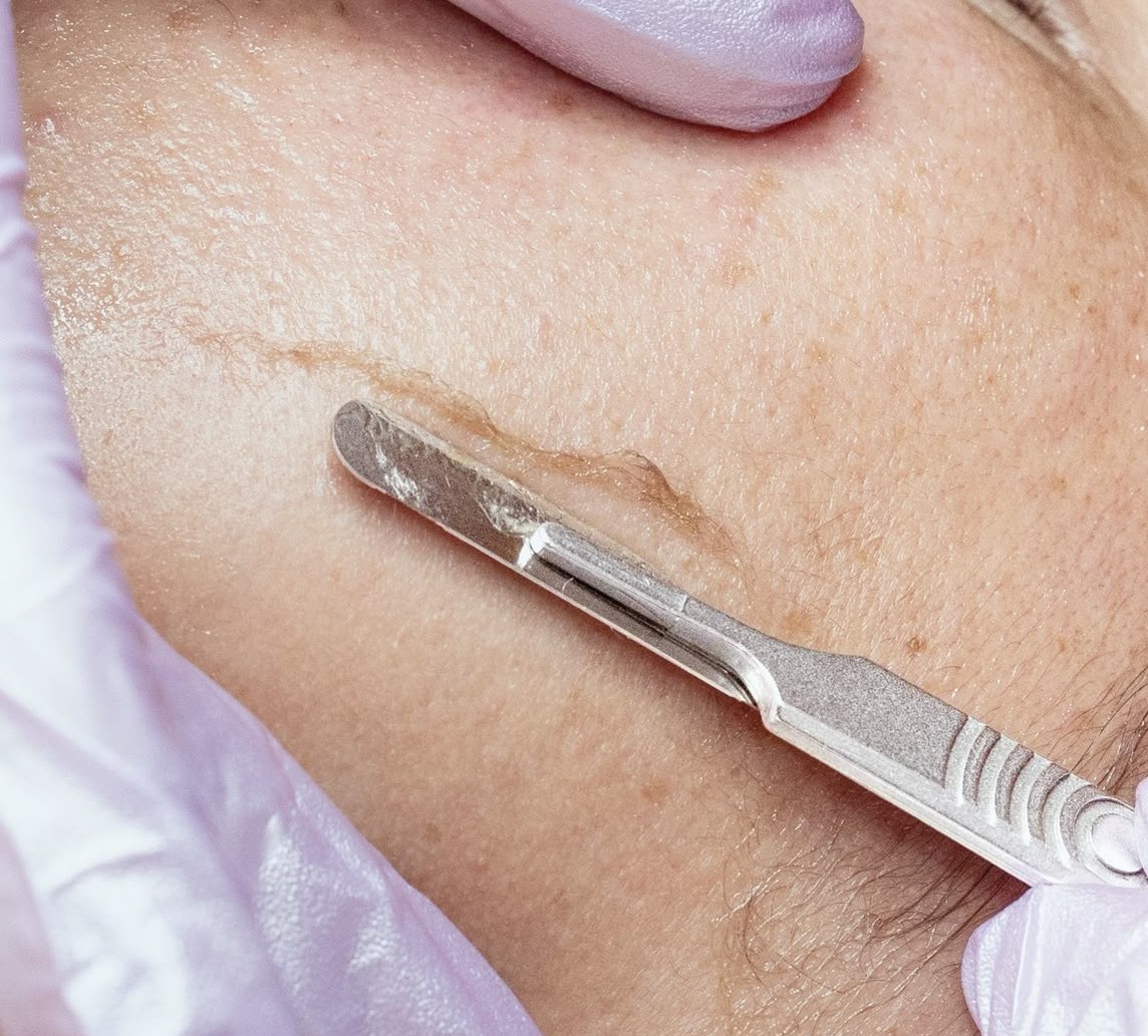 Renew & Glow Facial