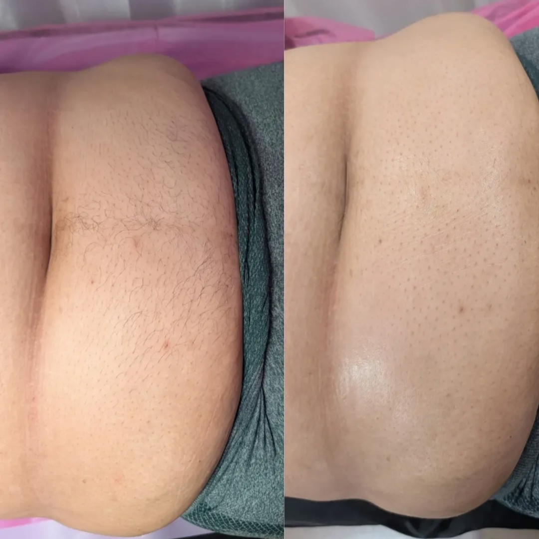 Stomach Wax at Skin by Kay in Orange, CA