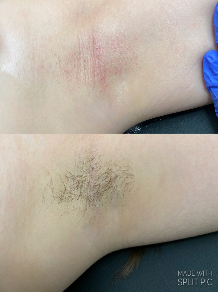 Underarm Wax