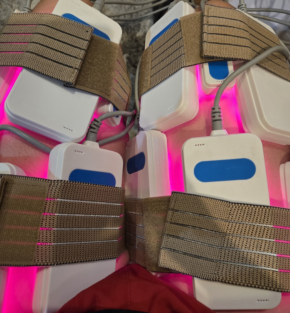 Cavitation + Laser Lipo Package 10