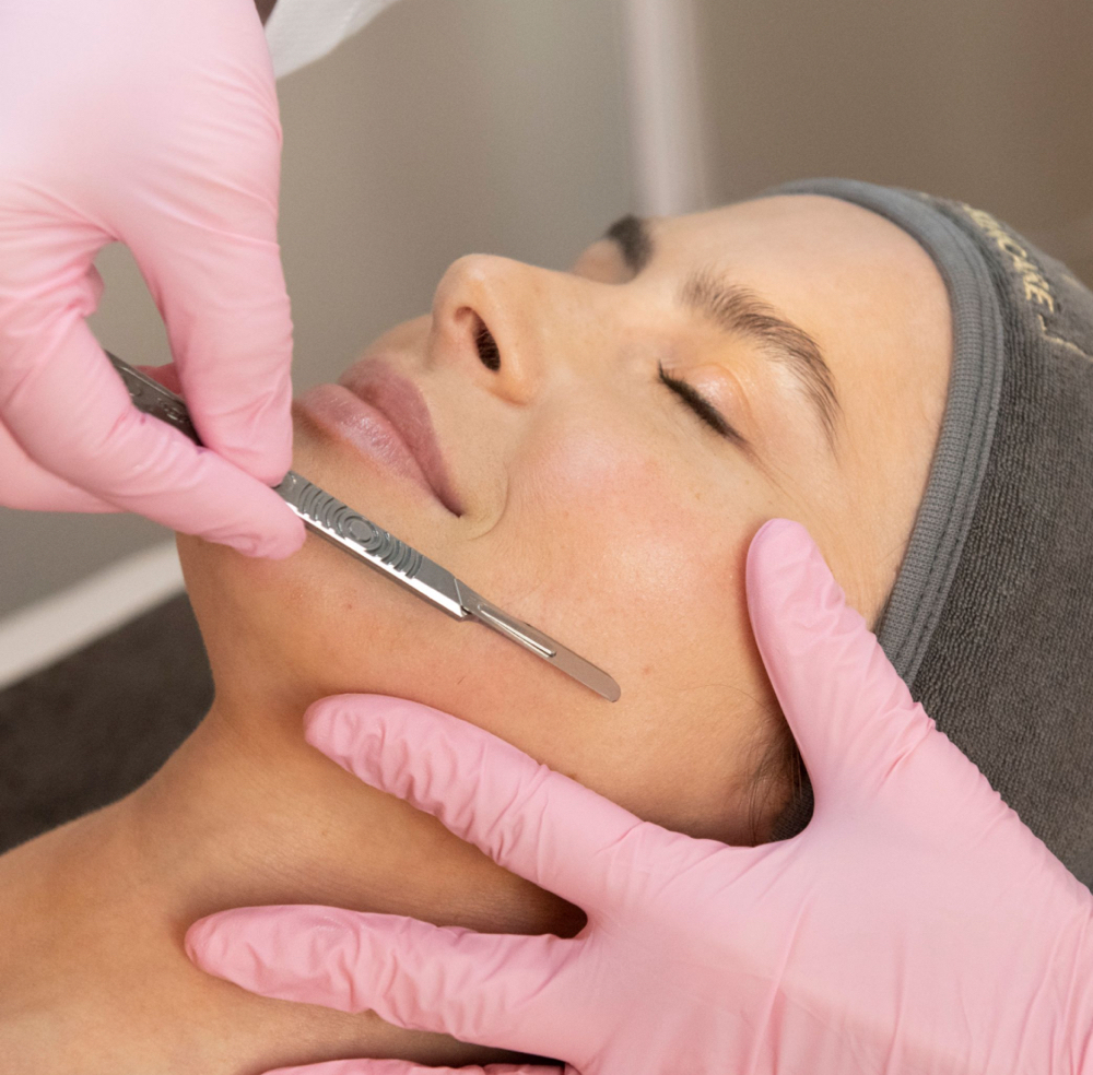 Dermaplaning Facial