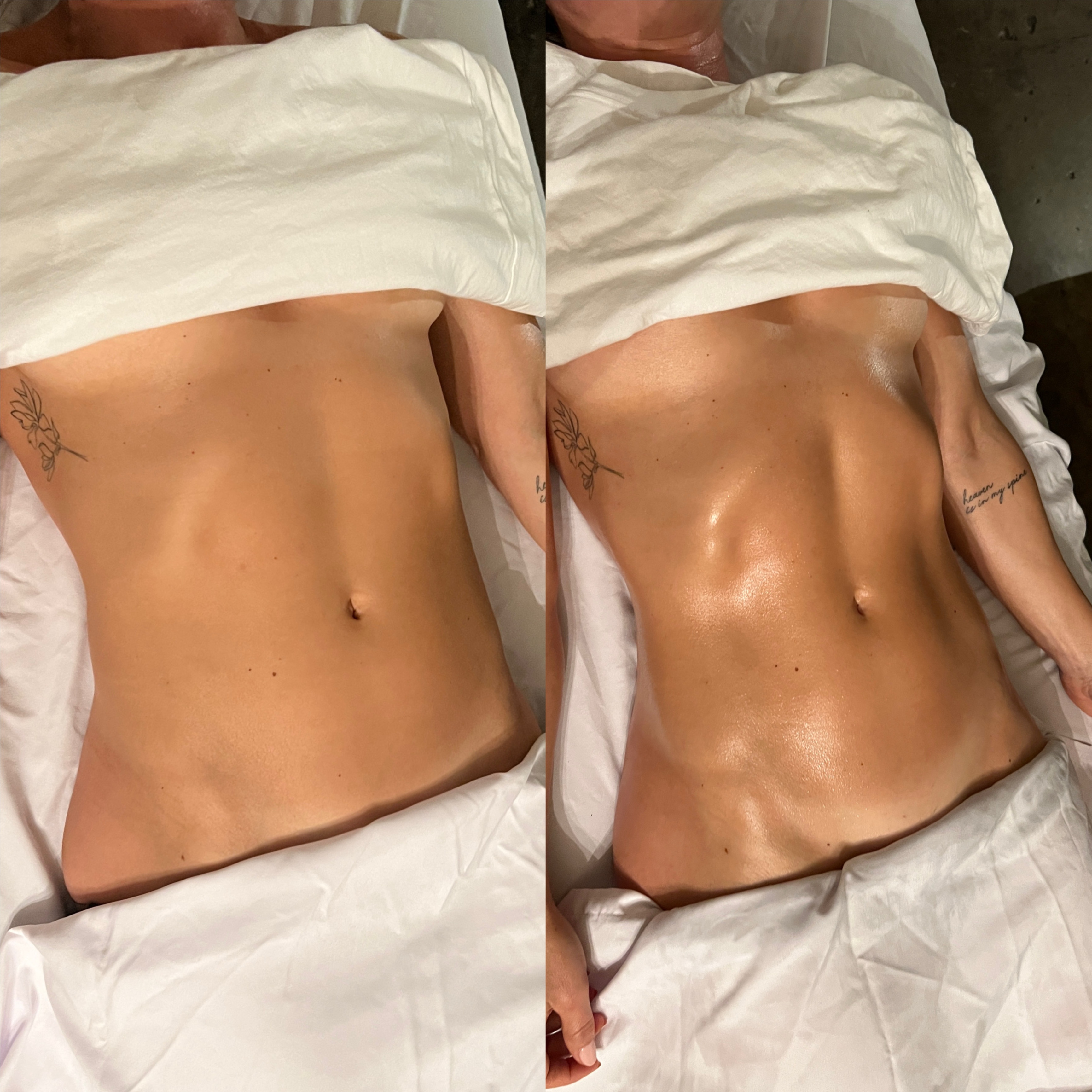 Lymphatic Drainage at Mayra Benitez in Glendale, CA