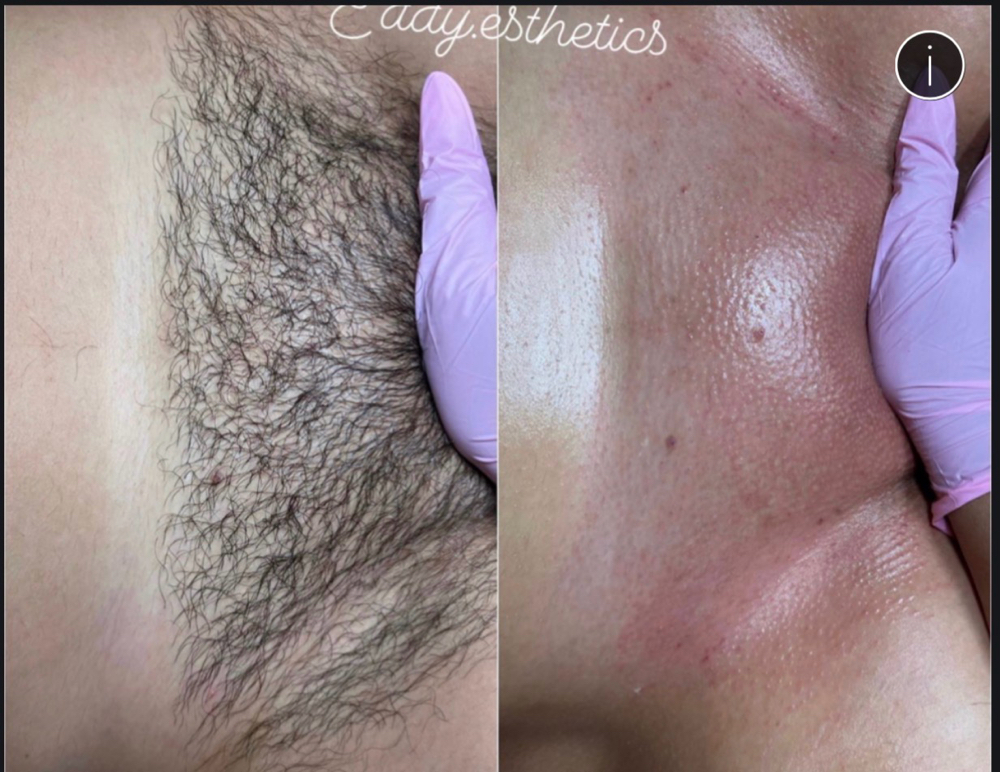 Brazilian Wax (Yonkers) (5pm-8pm)