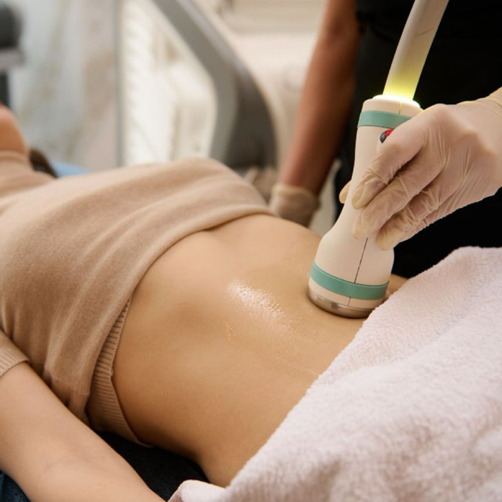 Body Sculpting at Aesthetik Nurse Kat in Riverside, CA
