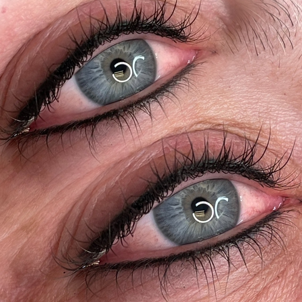 Lash Enhancement Follow up