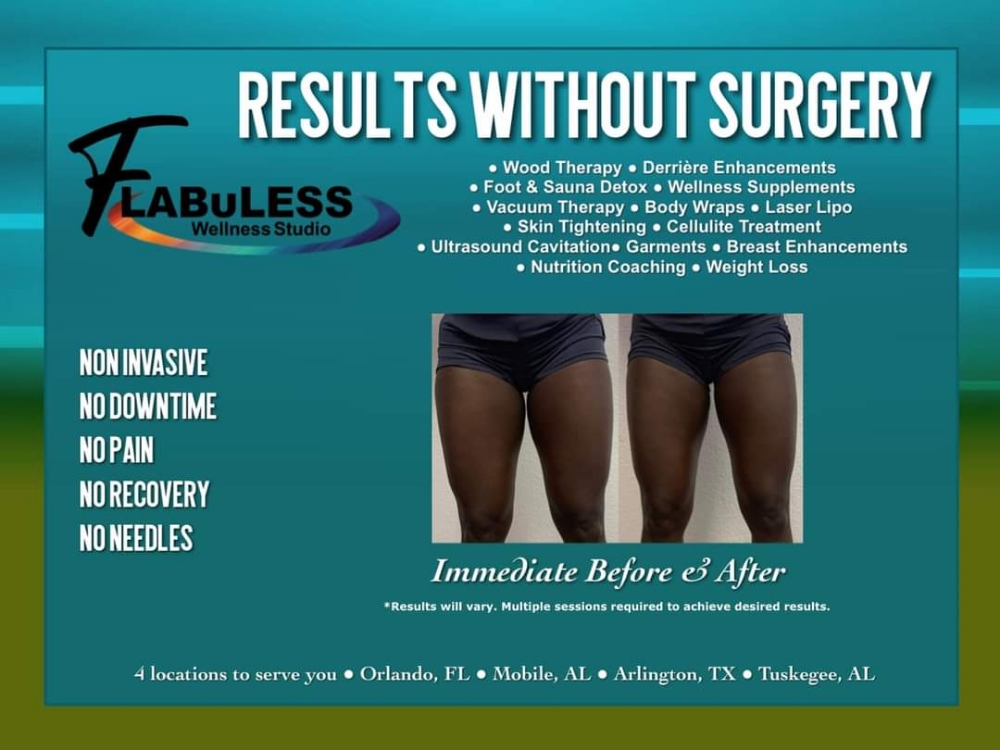 Cellulite Treatment (VIP Prepaid)