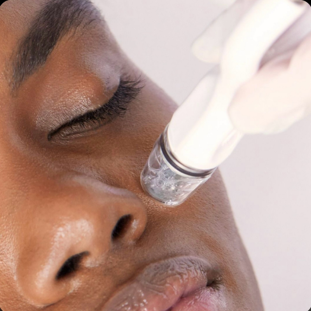 Micro-Dermabrasion Basic Facial at Healthy Skin Day Spa in Abilene, TX