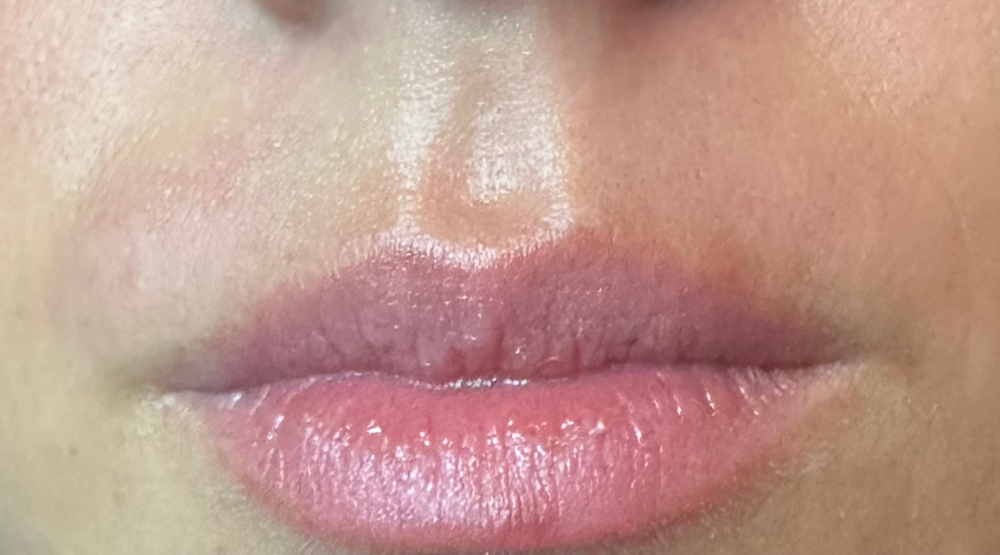 Upper Lip