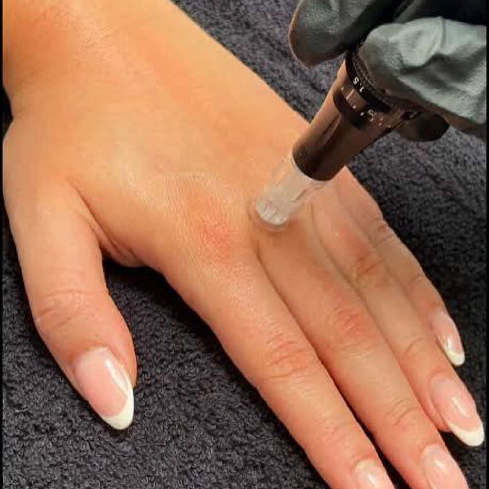 Add On Ageless Hand Renewal at Aesthetics by Abby in Alliance, OH