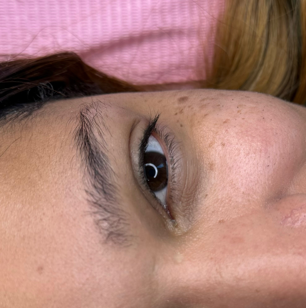Lash Removal