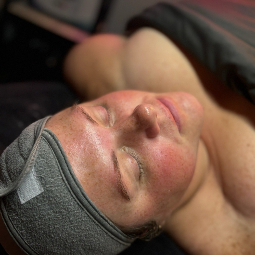 Acne Defense facial at Optimize Aesthetics & Wellness in Tewksbury, MA