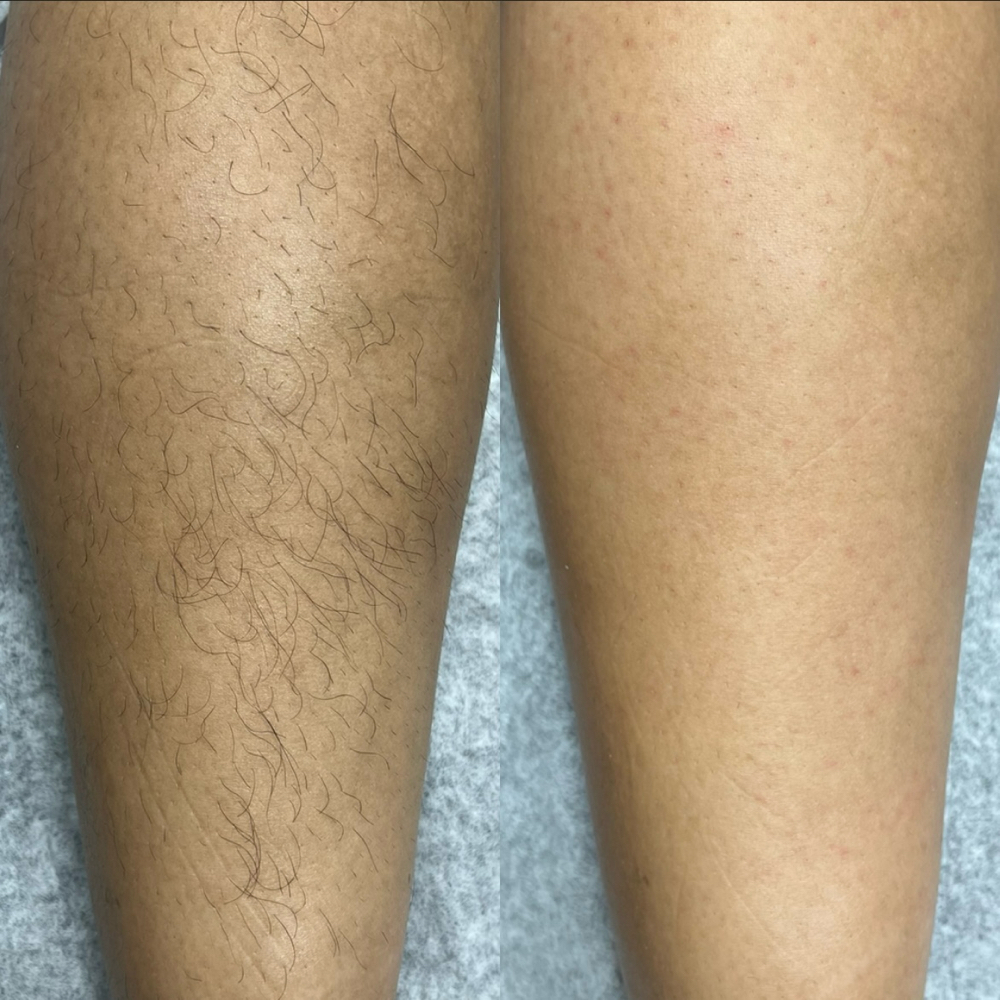 Half Leg Wax