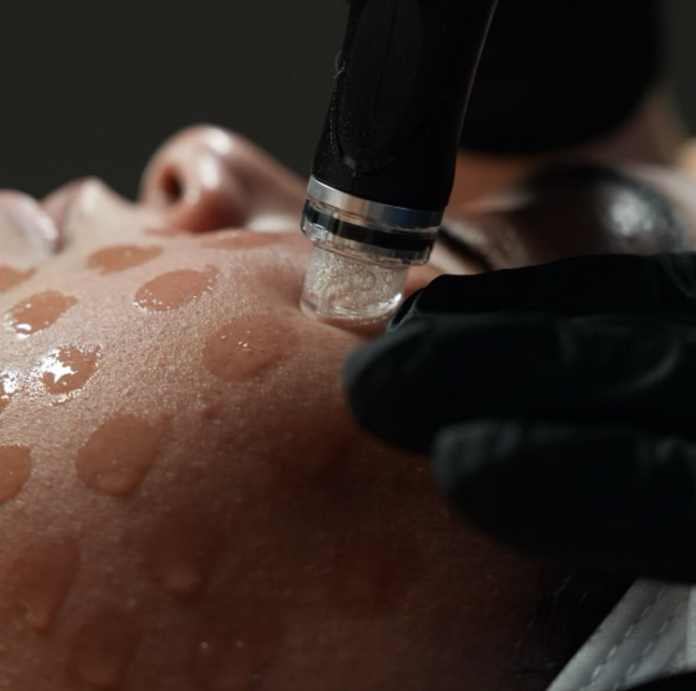 Deluxe Hydrafacial at Vaya Skin Club in Long Beach, CA