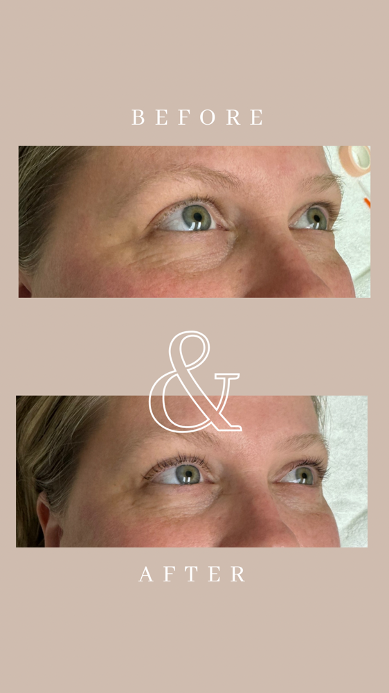 Lash Lift