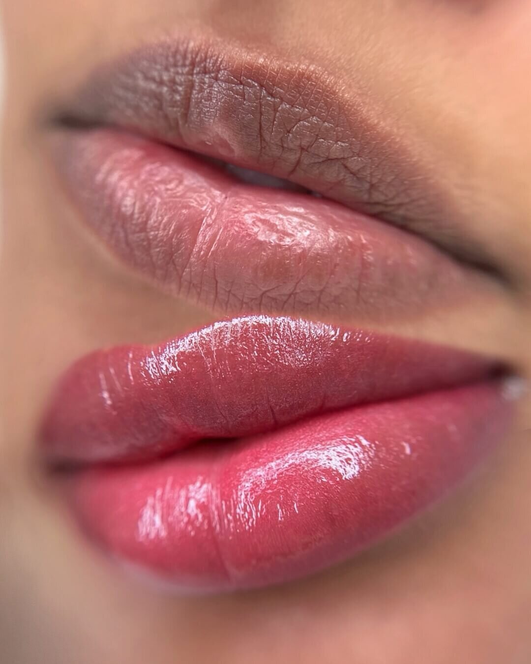 LIP NEUTRALIZATION