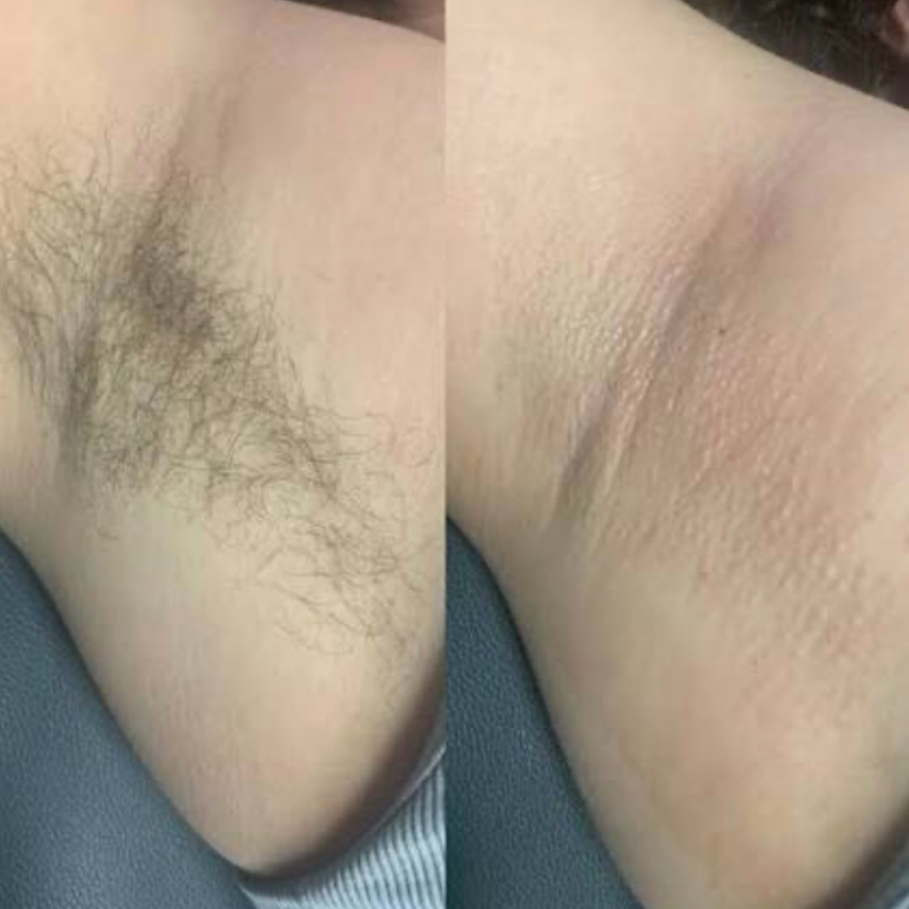 Underarm Waxing at Lash Goddess Of Albany in Albany, GA