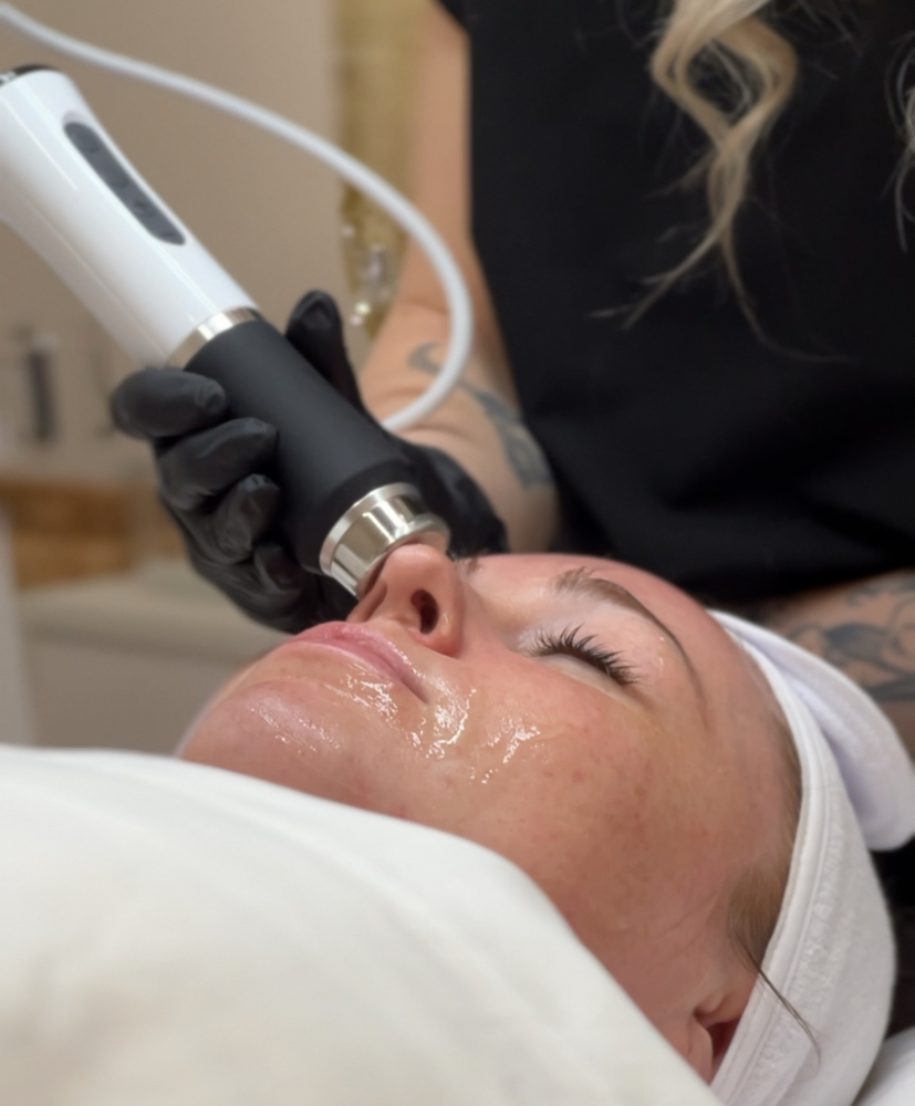 Oxygeneo Facial