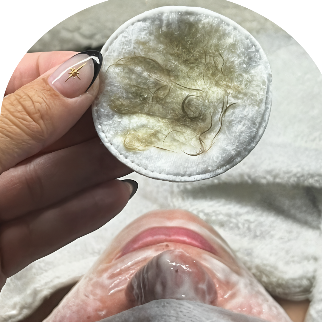 Dermaplane Add On at Loto Beauty Bar in Toledo, OH