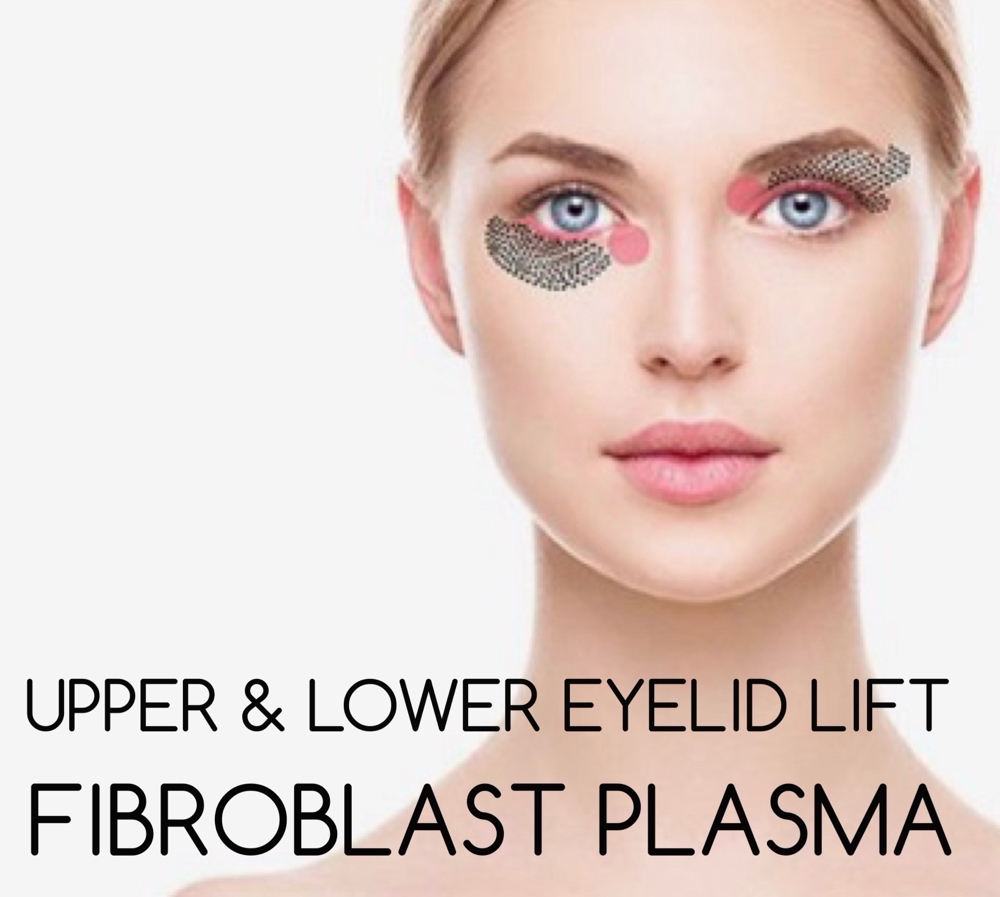 Fibroblast Eyelid Lift at Faces by DeAngela in New Brockton, AL