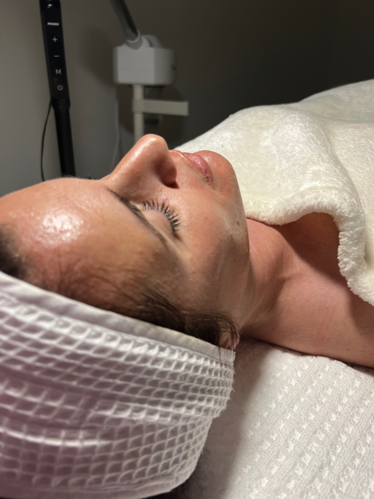 CUSTOM FACIAL