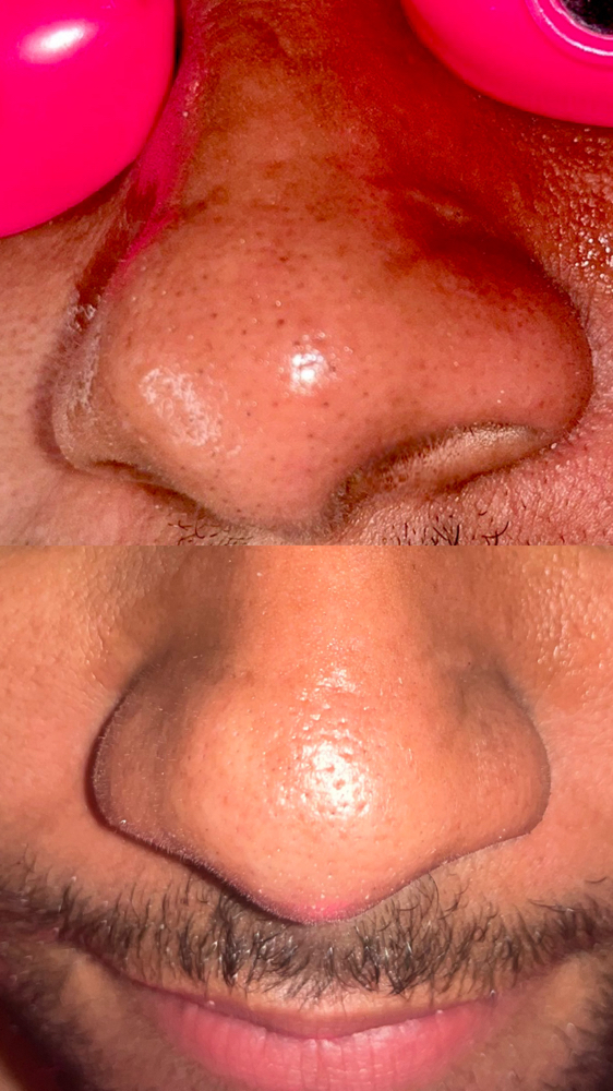 Pore Clarifying Facial