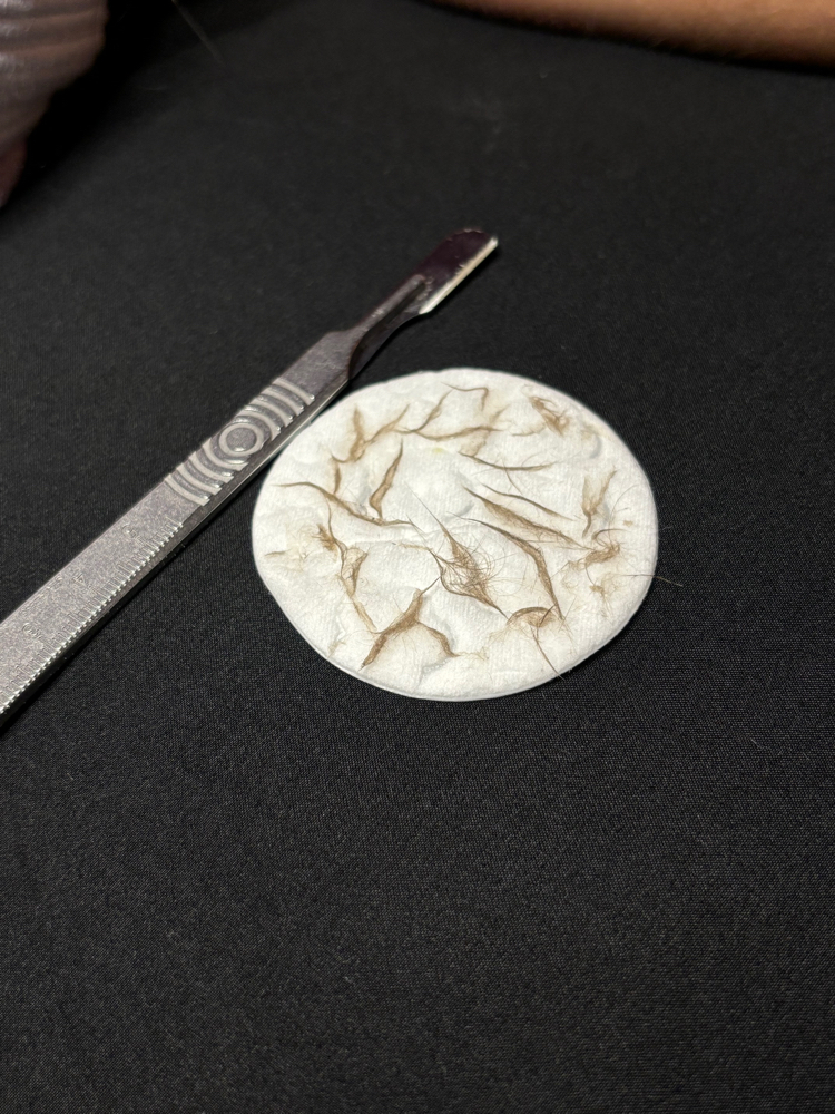 Dermaplaning Add-on